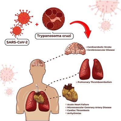 Frontiers Management of Cardiovascular Disease in Patients With